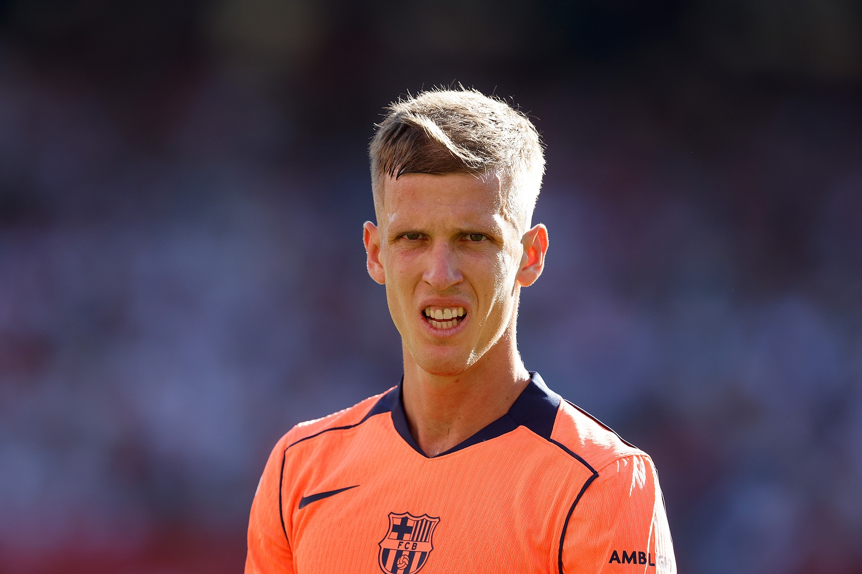 以色列球队, 但伤处位置, 周一奥尔莫